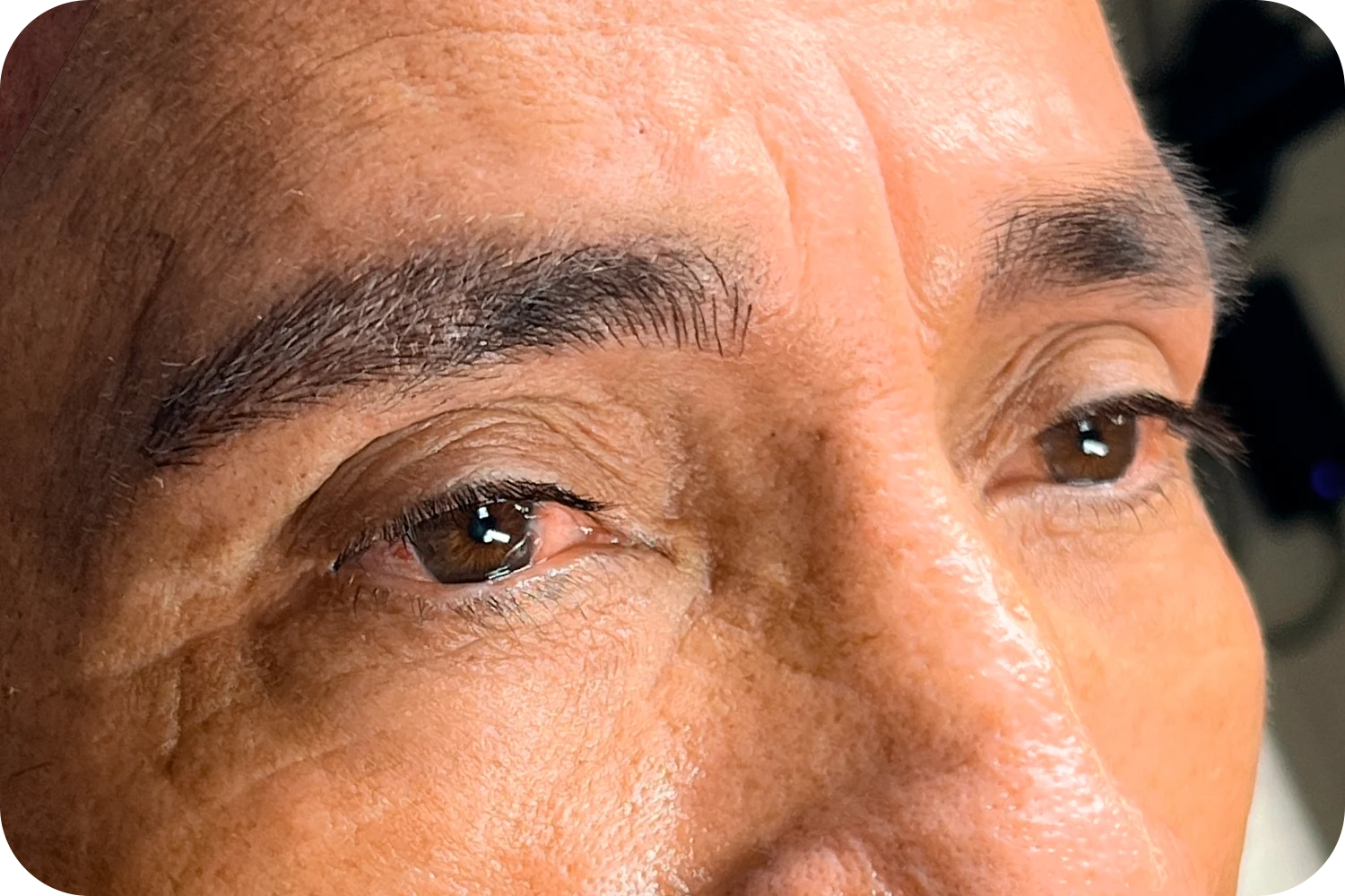 Microblanding-masculino-1