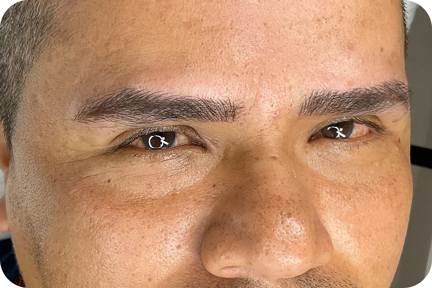 Microblanding-masculino-2